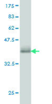 Monoclonal Anti-CAMK1 antibody produced in