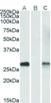 Anti-DYDC1 antibody produced in goat