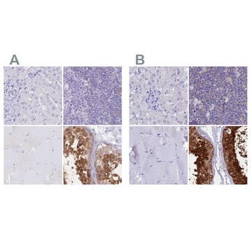 Anti-LZTFL1 antibody produced in rabbit