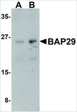 Anti-BAP29 (ab2) antibody produced in