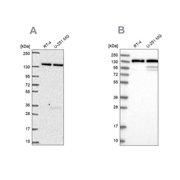 Anti-DDX46 antibody produced in rabbit