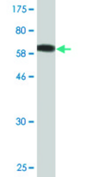 Monoclonal Anti-AKR7A2 antibody produced in