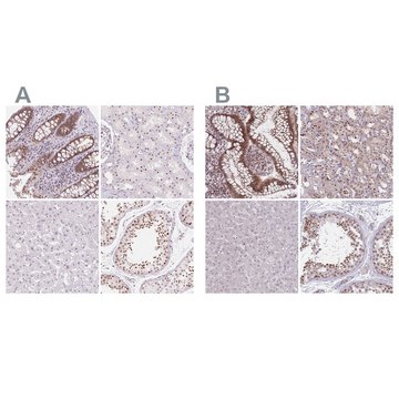 Anti-ZC3H14 antibody produced in rabbit