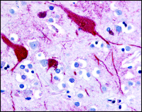 Anti-SLC5A9 (AB2) antibody produced in