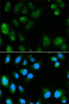 Anti-UCP3 antibody produced in rabbit