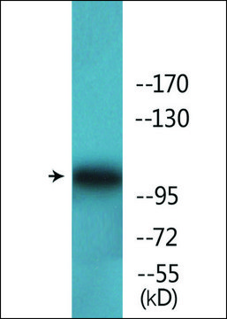 Anti-phospho-FAK (pTyr??¹) antibody produced in