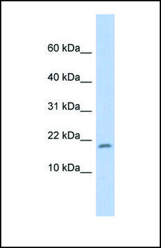 Anti-RPS15 antibody produced in rabbit