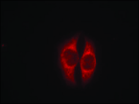 Anti-phospho-TP53 (pSer³?) antibody produced in