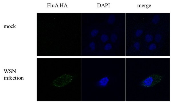 Monoclonal Anti-Influenza A virus H1N1