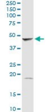 Anti-GMDS antibody produced in rabbit