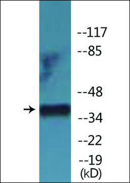 Anti-phospho-CDK7 (pThr¹??) antibody produced in