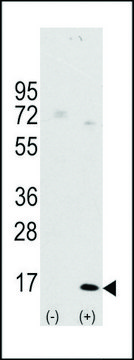 ANTI-LC3 (APG8A) (D106) antibody produced