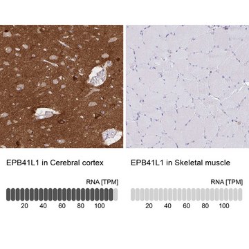 Anti-EPB41L1 antibody produced in rabbit