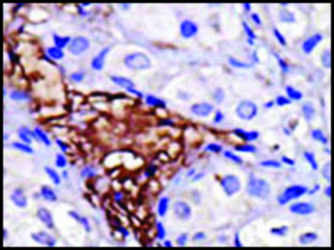 Anti-UBCE7IP5 (C-term) antibody produced in