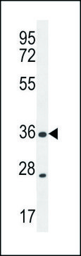 ANTI-XCR1 (C-TERM) antibody produced in