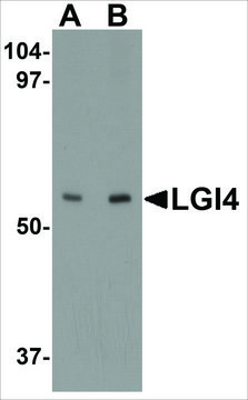 Anti-LGI4 (ab2) antibody produced in