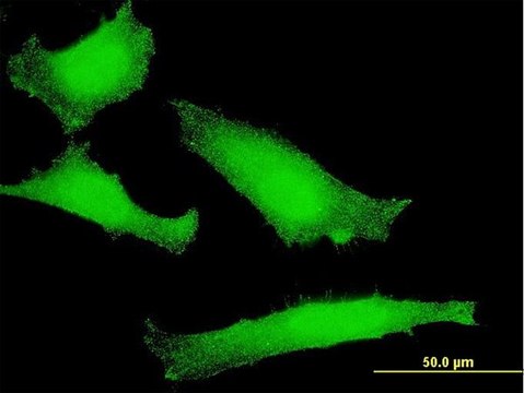 ANTI-FOXO1A antibody produced in mouse