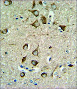 ANTI-ASMT (CENTER) antibody produced in