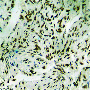 Anti-phospho-Elk1 (pThr?¹?) antibody produced in