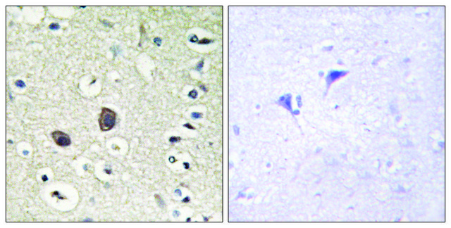 Anti-TIE2, C-Terminal antibody produced in