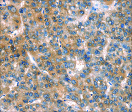 Anti-CACNA1A antibody produced in rabbit