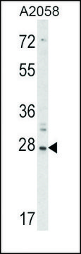 Anti-RIG-I (center) antibody produced in