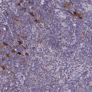 Anti-SNX11 antibody produced in rabbit