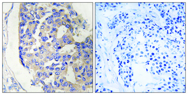 Anti-C1S, C-Terminal antibody produced in