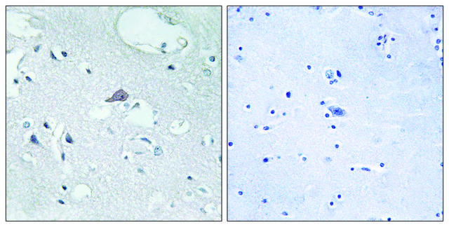 Anti-OPRM1 antibody produced in rabbit