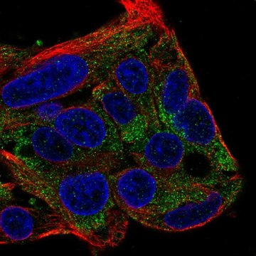 Anti-FBXL22 antibody produced in rabbit