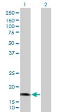 Anti-CALML5 antibody produced in rabbit