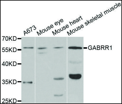 Anti-GABRR1 antibody produced in rabbit