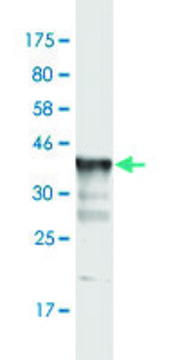 Monoclonal Anti-KCNC3, (C-terminal) antibody produced