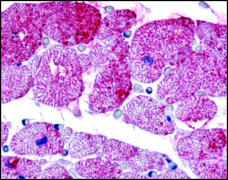 Anti-GPR175 antibody produced in rabbit