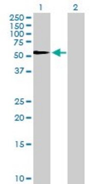 Anti-SERPINF1 antibody produced in rabbit