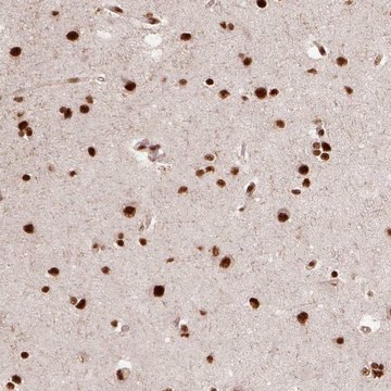 Anti-PPIG antibody produced in rabbit