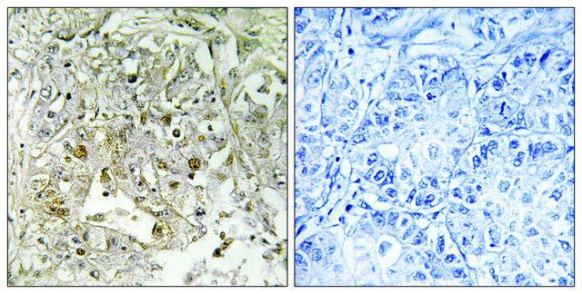Anti-p38 MAPK antibody produced in