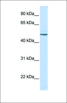 Anti-ADRB1 antibody produced in rabbit