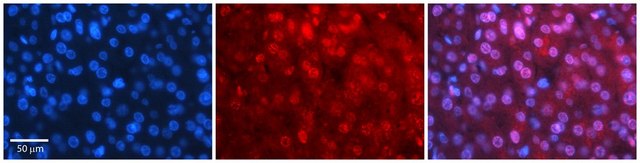 Anti-MBD2 antibody produced in rabbit