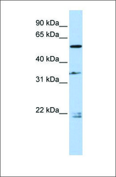 Anti-DPYSL2 antibody produced in rabbit