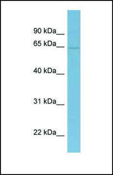 Anti-EYA1 antibody produced in rabbit
