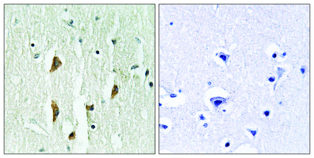 Anti-PAK1 antibody produced in rabbit