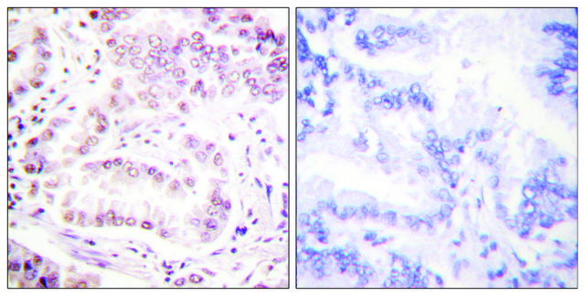 Anti-Histone H3 (Acetyl-Lys²?) antibody produced