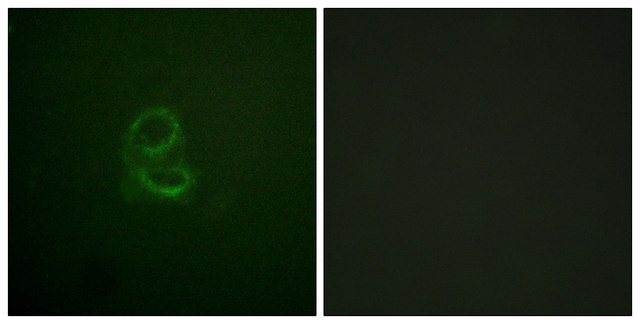 Anti-IL-4R antibody produced in rabbit