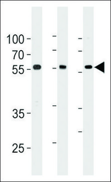 ANTI-TRIM6 (N-TERMINAL) antibody produced in