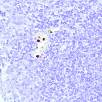 Anti-Neutrophil Elastase antibody, Rabbit monoclonal