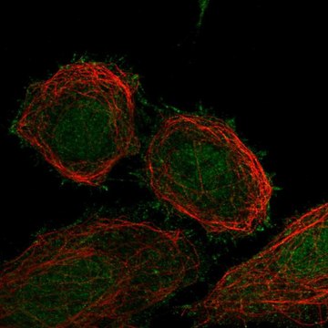 Anti-FBXO41 antibody produced in rabbit