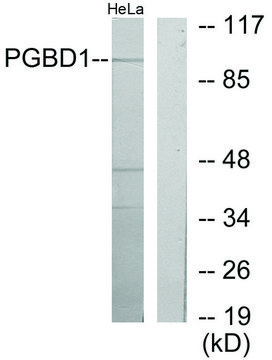 Anti-PGBD1 antibody produced in rabbit