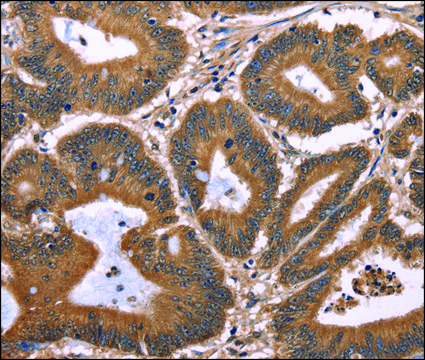 Anti-TDP2 antibody produced in rabbit