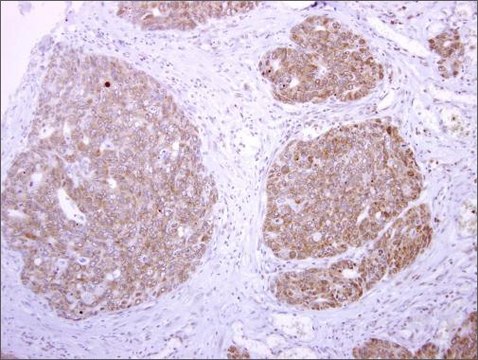 Anti-PLAT antibody produced in rabbit